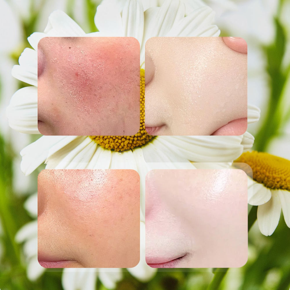 Face Mask Skincare - Maseczka do twarzy z różą, witaminą