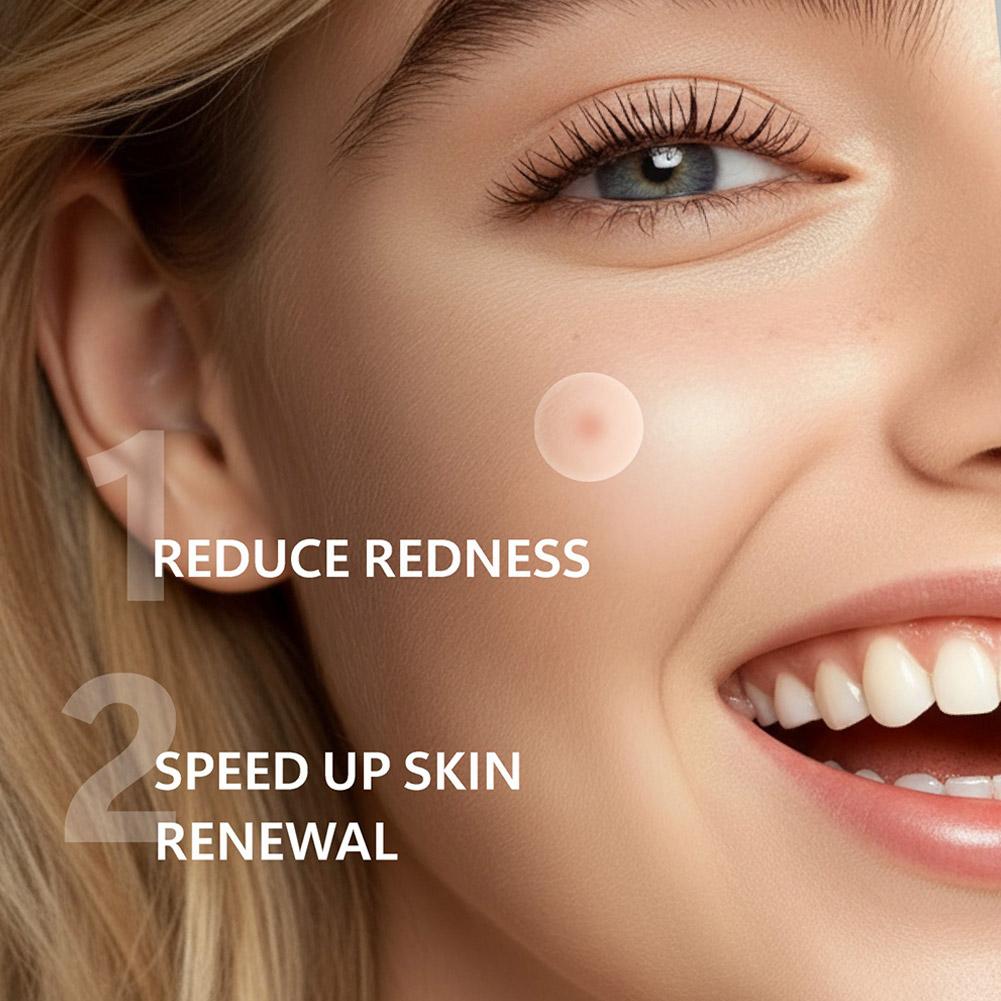 Niewidoczne plastry na trądzik – Skincare China recenzja i cena